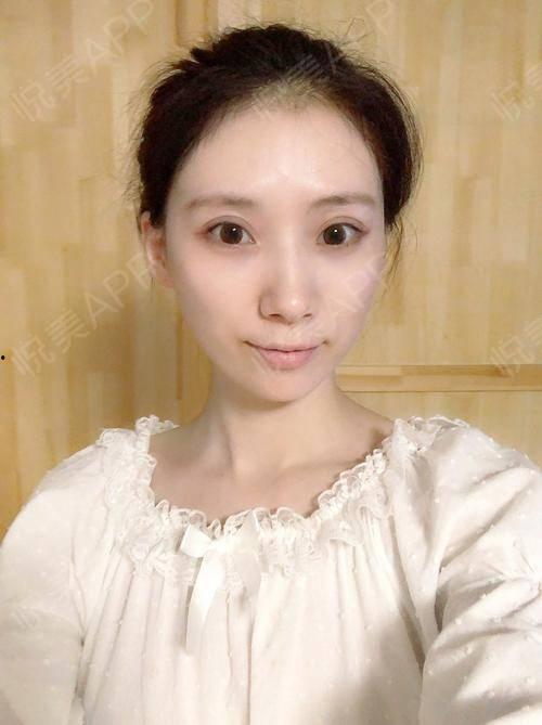 明星没有眼袋  第3张